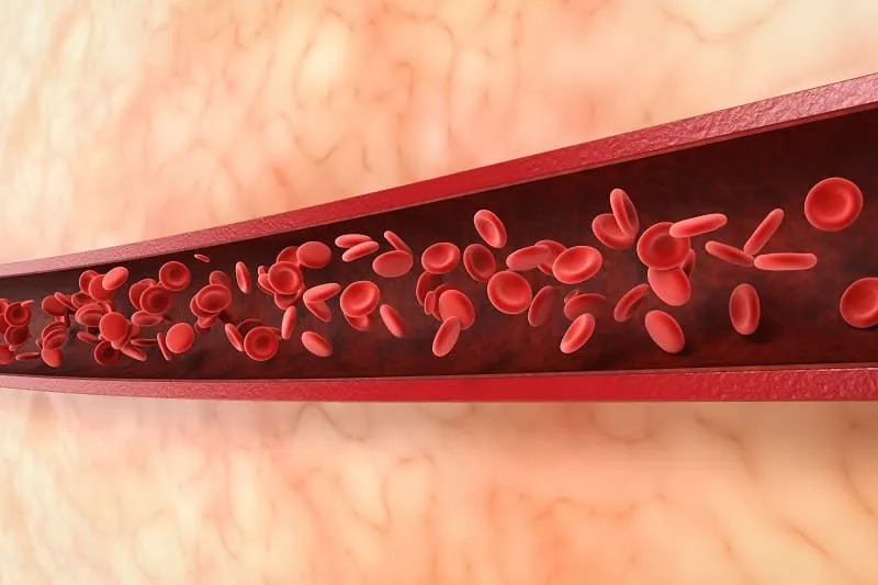 Angiología, Cirugía Vascular y Endovascular